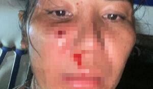 Police investigate after woman shot in face with rubber bullet